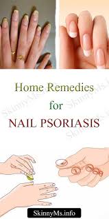 Skinnyms Daily Health Fitness Diet Yoga Tips Nail Psoriasis Nail Remedies Psoriasis