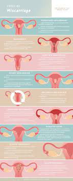 Of those, about half are probably due to a chromosome defect that would not allow. A Mother S Guide To Miscarriage And Moving On Dr Pamela Tan