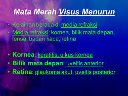 Check spelling or type a new query. Masalah Kesehatan Mata Ppt Video Online Download