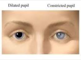 The Eyes Can Be Effective Indicators Of Drug Or Alcohol Abuse Http Grove Grovecan Org Uploads Signs Of Drug Or Alcohol Abuse Dilated Pupils Diagnosis Pupil