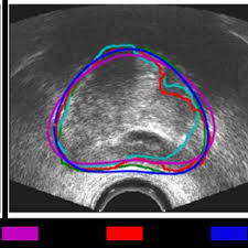 Currently accepted definitions of BOO and BPO