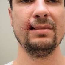 Summary of Perceptions of Plastic Surgery Before and After the Course