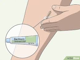 Do not take a bath or swim. How To Take A Shower After Surgery With Pictures Wikihow