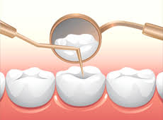 Without proper treatment, a tooth infection can spread and cause severe complications down the road. Tooth Infection Linked To Hair Loss
