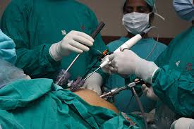 obesity operation ile ilgili görsel sonucu