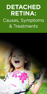 Detached Retina Know The Signs And Symptoms Detached Retina Symptoms Eye Health Symptoms