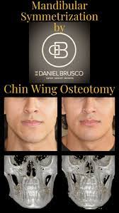 Daniel Brusco's Instagram, Twitter & Facebook