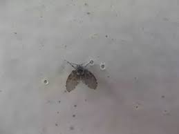 Mix a portion of white vinegar with a portion of dawn dishwashing liquid. We Are Seeing Small Flies In Our Bathroom Any Idea What Could Be Causing Them To Show Up Quora