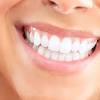 Available in lines like glamorous white, vivid white, and brilliance white, crest whitestrips. 1