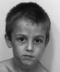 Kiedy znika pół twarzy…