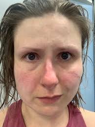 Harriet Rudd's Instagram, Twitter & Facebook