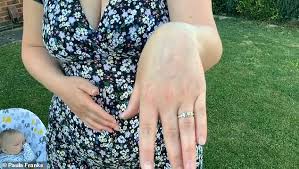 Heartwarming moment boyfriend proposes to his NHS mental health worker  during the Clap for Carers