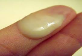 This discharge is generally thin and stringy and indicates the most fertile period for a woman to try and get pregnant. Family Magazine Post Ovulation Cervical Mucus