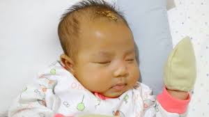 Cara Tradisional Menyembuhkan Pilek Flu Pada Bayi Dengan Buah Pala Kumparan Com