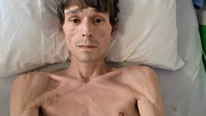 Fundraiser for Nick Barreto by Cancer Conquerors : Help Nick Overcome Stage  4 Cancer with Mistletoe therapy.