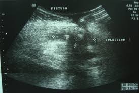 Los sensores de ultrasonido de sick utilizan las características del sonido. Ultrasonido De Pared Abdominal Figura 1 Download Scientific Diagram
