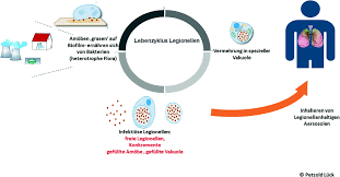 Im gegensatz dazu steht die legionellenpneumonie (legionellose oder auch „legionärskrankheit). Legionellen Springerlink