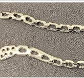 A reconstruction locking plate (above) and anatomic locking ...