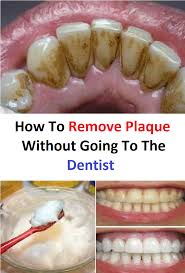 How To Remove Plaque Without Going To The Dentist Teeth Health Healthy Teeth Plaque Removal