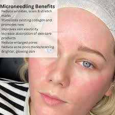 Victoria Elizabeth SPMU