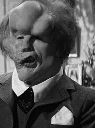 The Heartbreaking True Story of the Elephant Man