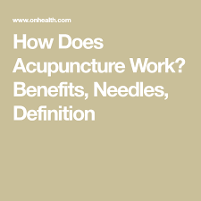 How Does Acupuncture Work Benefits Needles Definition Work Benefits Acupuncture Acupuncture Benefits