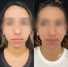 Coco Med Spa, 327 11th Ave N, Saint Petersburg, FL 33701, US