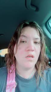 Jessica Ice Skating Injury Her Now