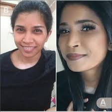 Vitiligo Concealer Starter Kit