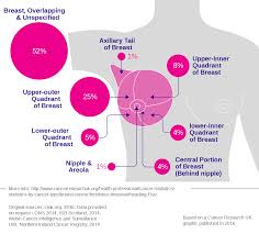 Sometimes cancer cells spread to other parts of the body through the blood or lymph system. File Breast Cancer Incidence By Anatomical Site Females Svg Wikimedia Commons