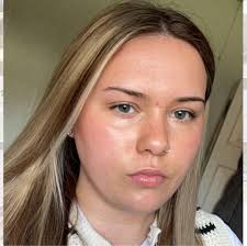 Harley Rat Ear Infection and Skin Care