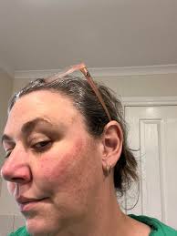 Is there a mask I can buy somewhere that won't burn my skin? I'm already  using the padded mask and it's still burning the bridge of my nose. My skin  is sensitive