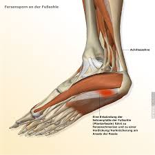Plantarfasziitis Schmerzen An Der Fusssohle Der Spiegel