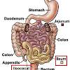 Where they connect is called the ileocecal junction because the last part of small intestine called illum is connected to part of large intestine or colon called cecum. 1