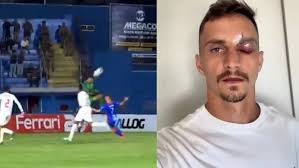 SC: atacante do Marcílio Dias leva joelhada na cara de goleiro em lance  forte