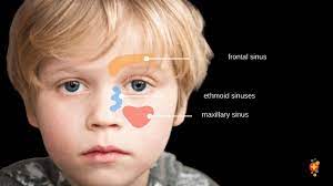 We did not find results for: Orbital Fractures