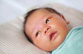 Begitu hati telah berkembang penuh suatu keadaan saat kadar glukosa dalam darah bayi rendah, dapat disebabkan terlalu sedikit menyusu. Mata Bayi Kuning Ini Penyebab Gejala Dan Cara Mengatasinya Catat Orami