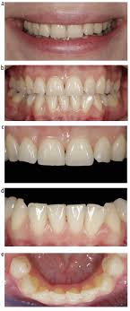View 450 aesthetics dental group (www.450aesthetics.com) location in california, united states , revenue, industry and description. Evaluation Of Smartphone Dental Photography In Aesthetic Analysis British Dental Journal