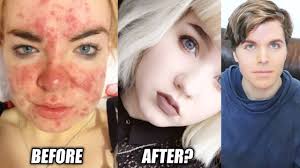 makeup vs no makeup s before and