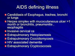 Image result for AIDS-Defining Illness