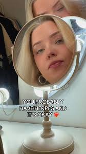 Don't limit yourself to only dating other people with herpes though, m...