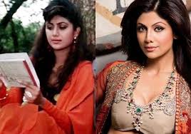 Shilpa Shetty Plastic Surgery The Emerging India Results do not constitute a promise or representation of any particular outcome or experience. shilpa shetty plastic surgery the