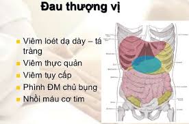 Phù đổng thiên vương (chữ hán: Vung ThÆ°á»£ng Vá»‹ Náº±m á»Ÿ Ä'au Triá»‡u Chá»©ng Ä'au ThÆ°á»£ng Vá»‹ Dáº¡ Day
