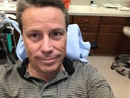 I am THAT guy! Never got my wisdom teach out as a kid! Brutal. On the sofa  off the grid for a few days! #abc7eyewitness #wisdom #teeth