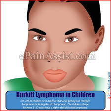 For example, lymphoma in the tonsils will appear as a sore throat, while a tumor in the larynx may cause hoarseness or breathing problems, and one in the sinuses will cause sinusitis. Burkitt Lymphoma Types Signs Symptoms Stages Treatment Survival Rate Prognosis