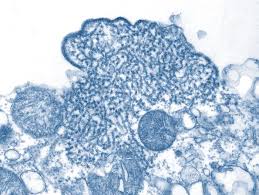 Learn about nipah virus infection (niv), a zoonotic disease that pigs and fruit bats can transmit to humans. Nipah Virus Wikidata