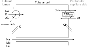 It is used to treat high blood pressure. Furosemide And Acute Kidney Injury In Neonates Adc Fetal Neonatal Edition