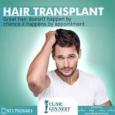Best Hair Transplant Clinic In 2021 Hair Transplant Best Hair Transplant Cool Hairstyles