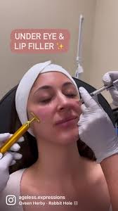 Does your face need a little...