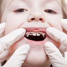 Image result for Disease